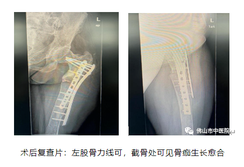 微信截图_20230316165654.png