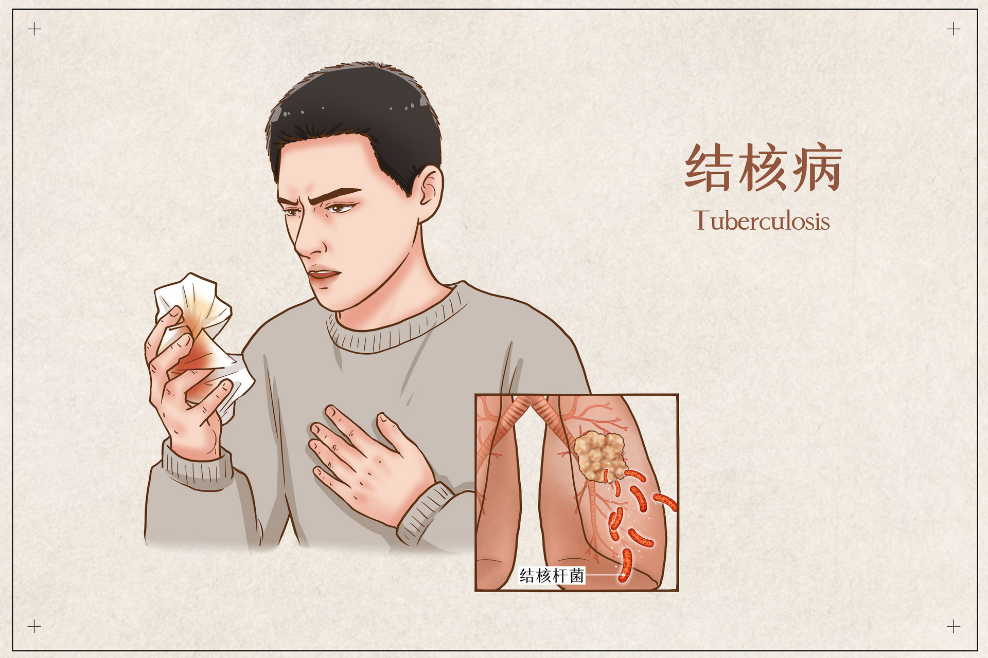 摄图网_401799106_banner_结核病医疗插画（企业商用）.jpg