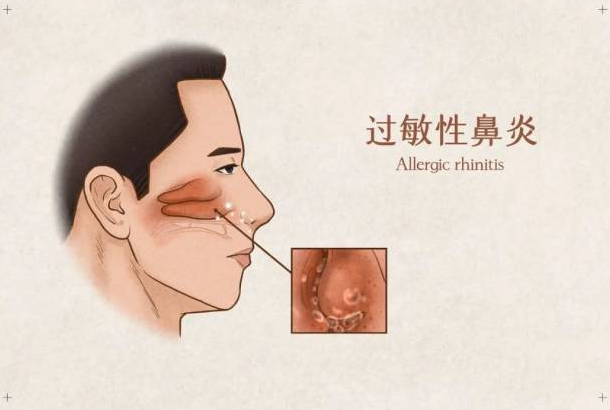 微信截图_20230425185513.png