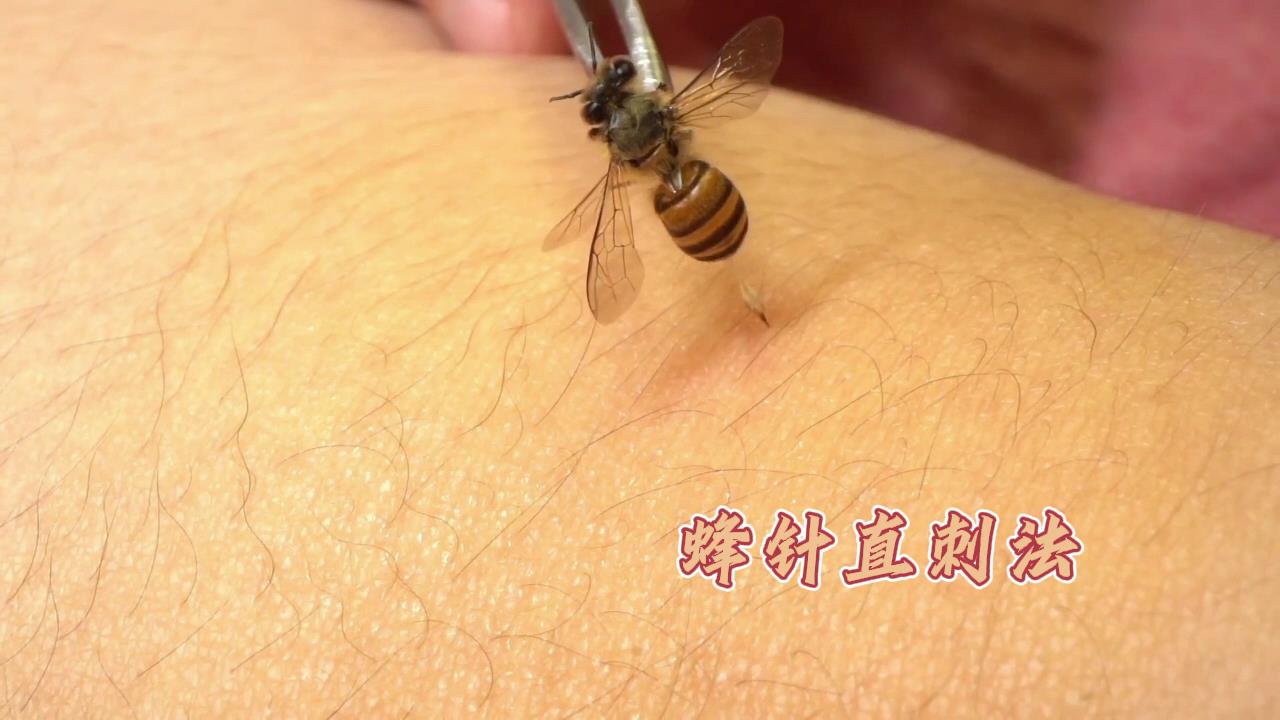 黄中粱-蜂针（加字幕）[00-00-12][20231010-110251575].jpg