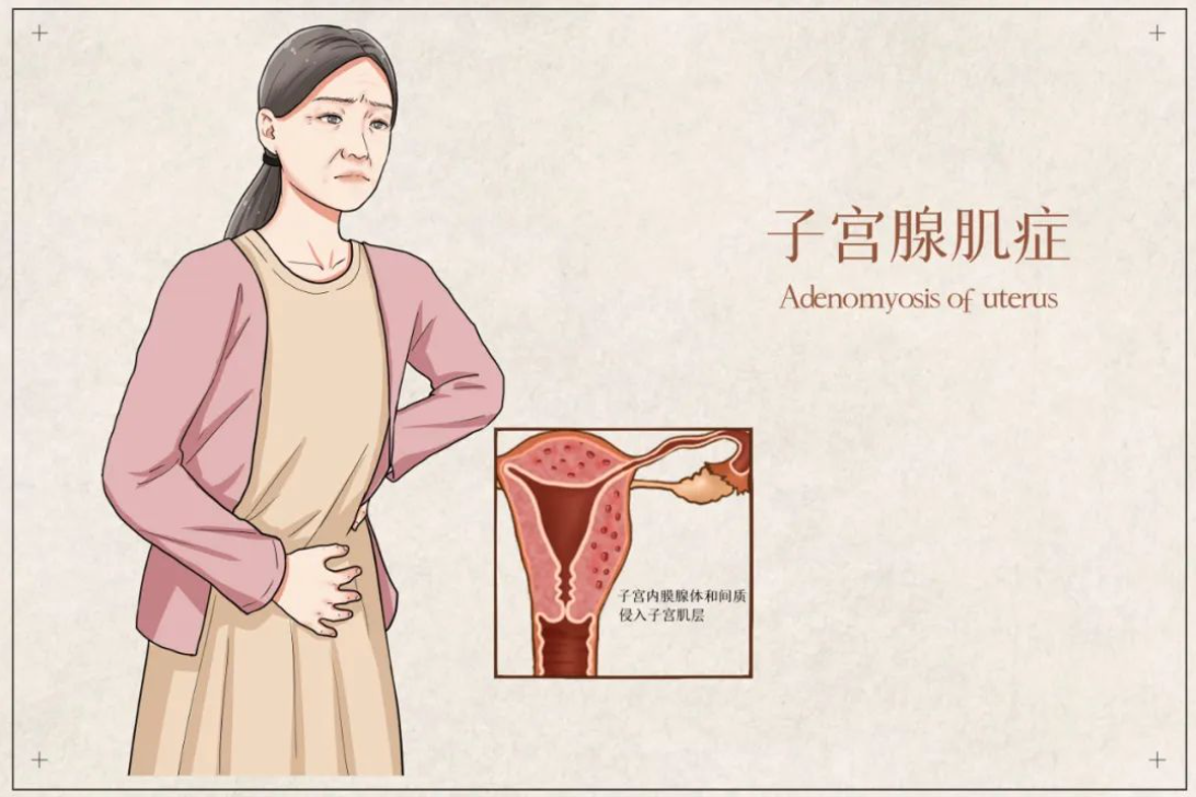 微信截图_20230904181750.png