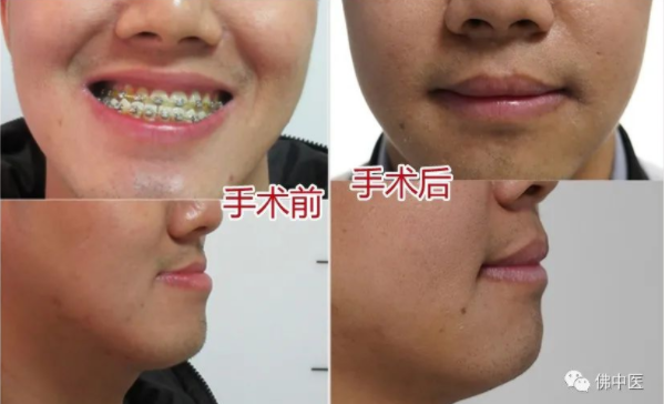 微信截图_20230322131021.png